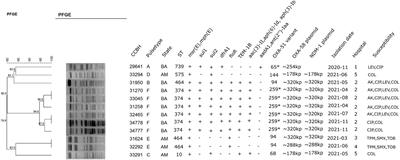 Genomic study of Acinetobacter baumannii strains co-harboring blaOXA-58 and blaNDM-1 reveals a large multidrug-resistant plasmid encoding these carbapenemases in Brazil